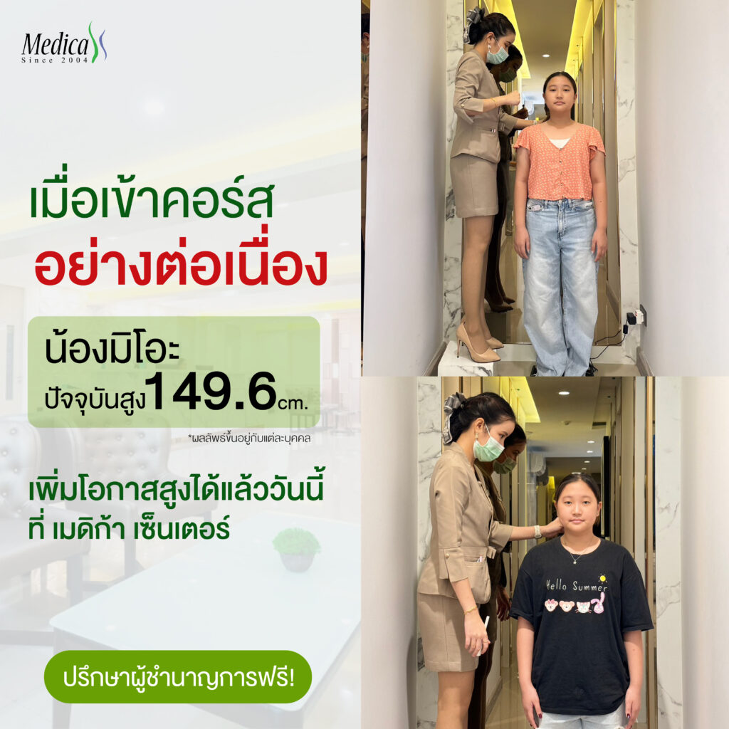 รีวิวผลลัพธ์โปรแกรมเพิ่มความสูงของน้องมิโอะ ที่คลินิกเพิ่มความสูง เมดิก้า เซ็นเตอร์
