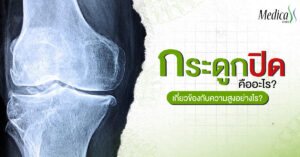 กระดูกปิด คือ อะไร ?