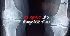 กระดูกปิดยังสูงได้อีกไหม-เมดิก้า คลินิกความสูง