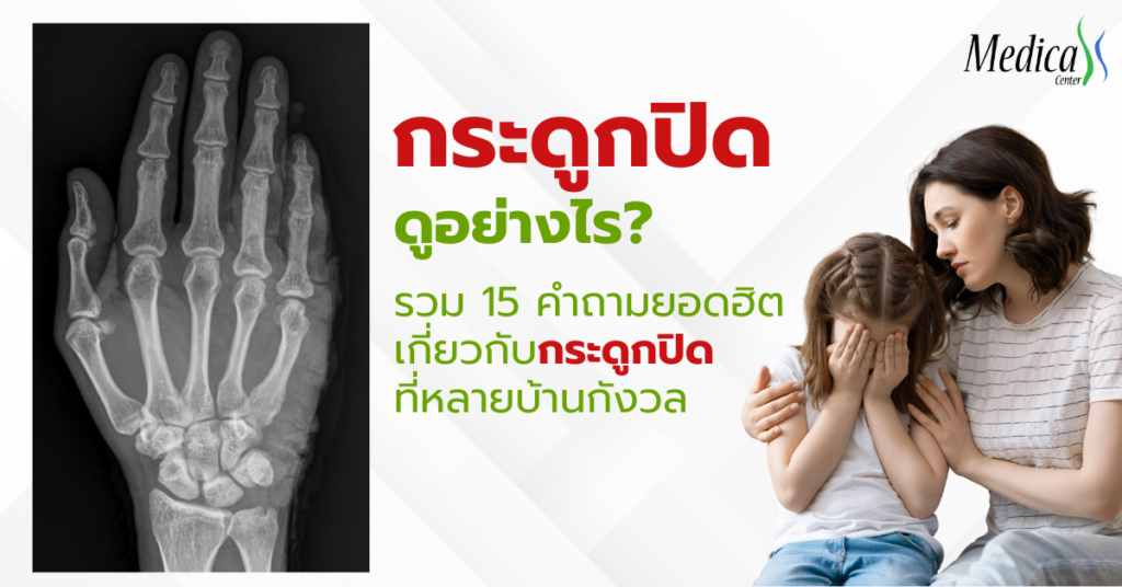 กระดูกปิดดูอย่างไร