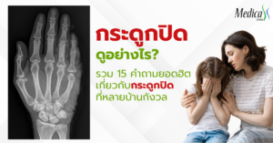 กระดูกปิดดูอย่างไร