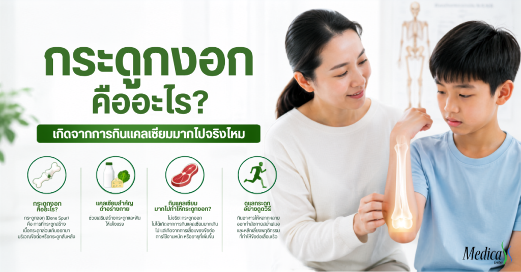 กระดูกงอก คืออะไร-เมดิก้าคลินิกความสูง